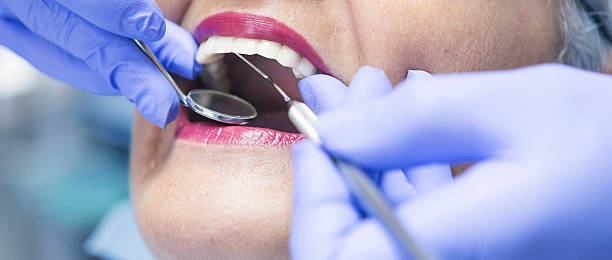Best Emergency Dental Filling Replacement  in Ol, LA